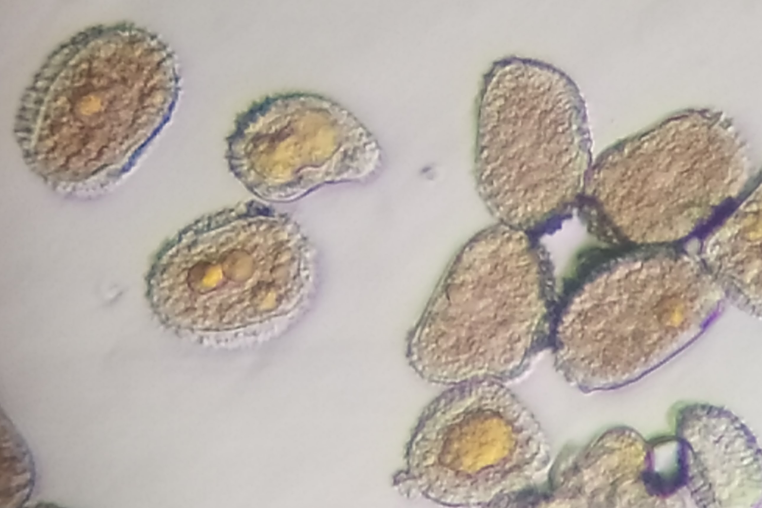 <p><b>Urediniosporos de Hemileia vastatrix vistos ao microscópio óptico.</b></p><p>Autor: Ricardo José Domingues</p>